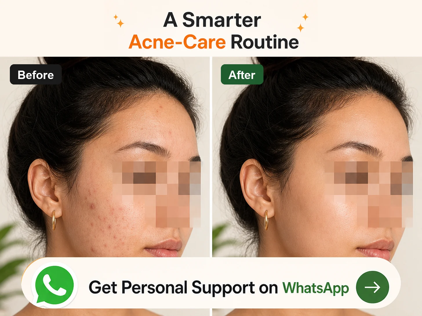 Acne-care routine · Before-and-after layout